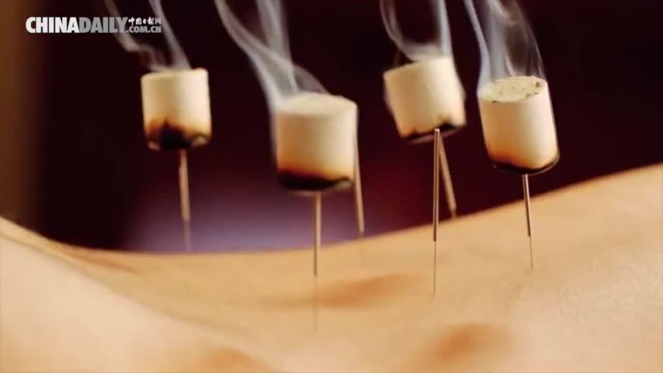 Acupuncture